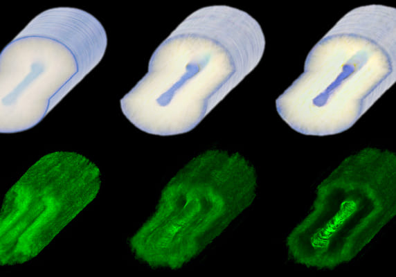 Presentation by KOSÉ awarded Grand Prize at the International Federation of Societies of Cosmetic Chemists (IFSCC) World Congress